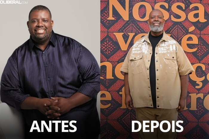 Péricles revela truque para perder 50 kg sem bariátrica; veja o antes e ...