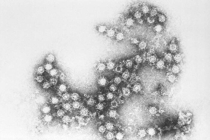 O vírus Coxsackie: sintomas parecidos com os de outras doenças merecem alerta redobrado