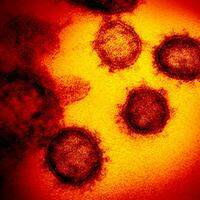 Imagem de microscópico mostra o novo coronavírus, responsável pela doença chamada Covid-19