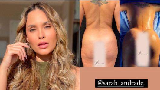 Ex-BBB Sarah Andrade é internada após cirurgias plásticas e abre o