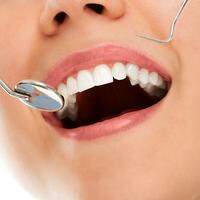 Ter uma boa higiene bucal diária e consultar o dentista regularmente ajuda a aumentar a vida útil das lentes de contato