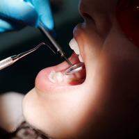 No tratamento de canal é possível fazer reparos na parte interna do dente