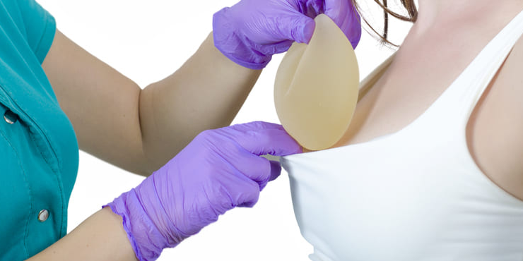 Como colocar silicone de graça no SUS? Veja quem pode e o que é preciso para conseguir | Saúde | O Liberal Como colocar silicone de graça no SUS? Veja quem pode e o que é preciso para conseguir | Saúde | O Liberal