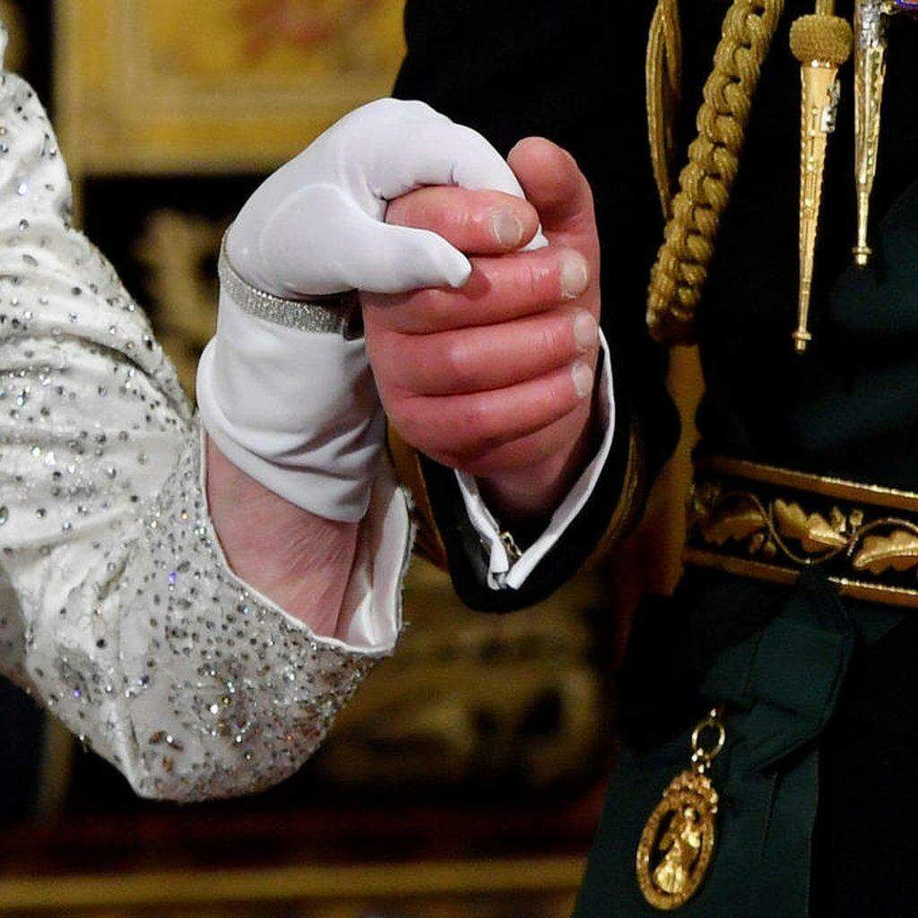 Dedos de salsicha': especialista explica motivo dos dedos inchados e  vermelhos do rei Charles III | Mundo | O Liberal