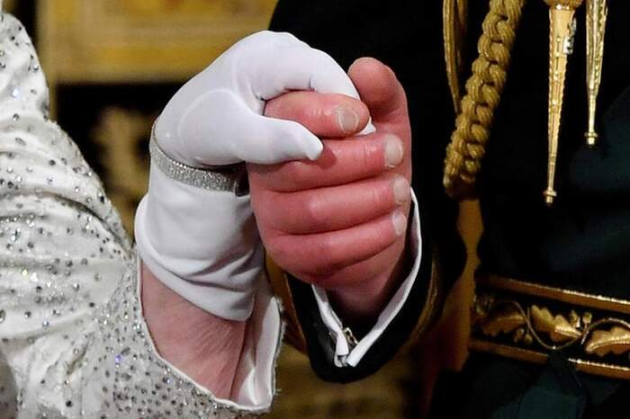 Dedos de salsicha': especialista explica motivo dos dedos inchados e  vermelhos do rei Charles III | Mundo | O Liberal