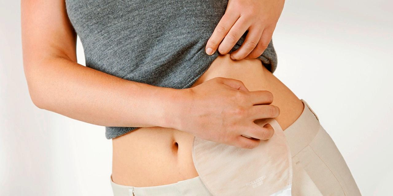 Dia Nacional da Pessoa Ostomizada: campanha prevê combate ao preconceito | Pará | O Liberal