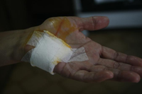 Mãos da mãe da jornalista, à época do ataque: ferimentos a faca