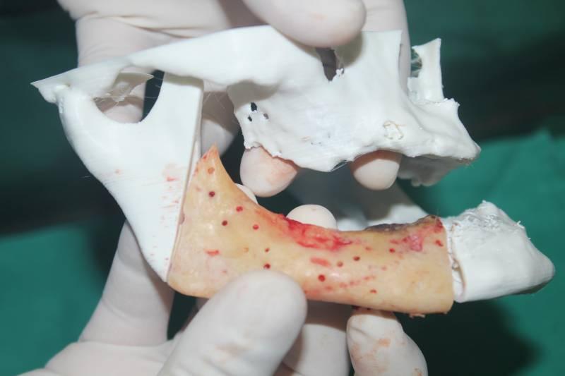 Rosto reconstruído com tecnologia 3D