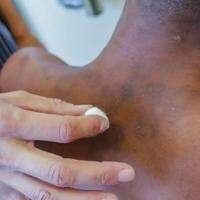L'objectif est l'opération de diagnostic précédente pour étendre l'accès et réduire le risque d'invalidité.