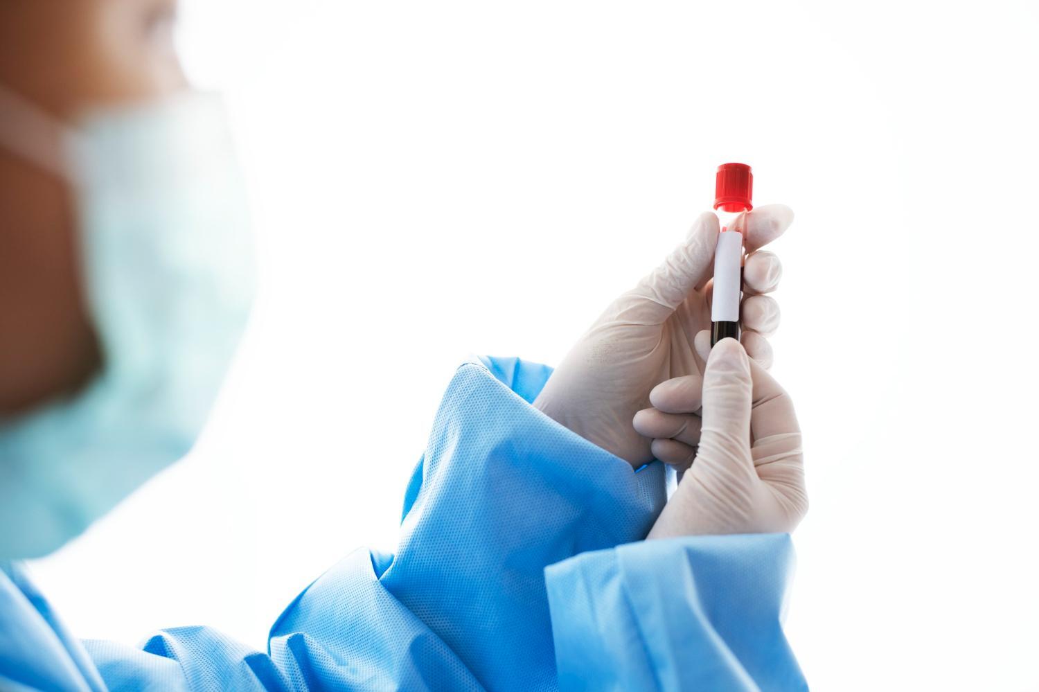 Número de novos casos de HIV cai em todo o mundo desde 2010, mas cresce no Brasil - QTU Questões do Universo