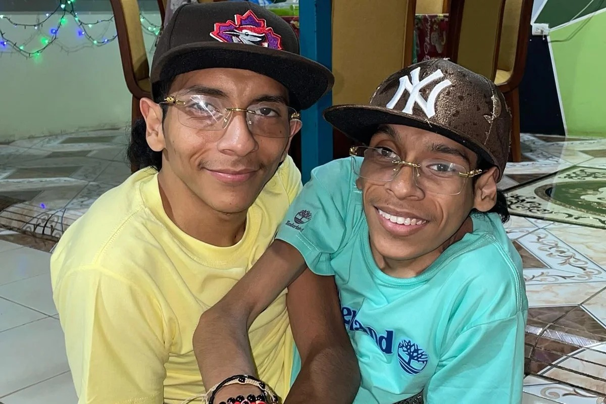 Gêmeos siameses do Equador morrem aos 27 anos na Colômbia